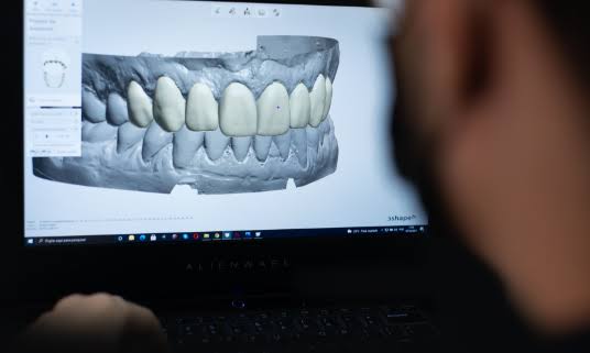 Planejamento digital do sorriso em software 3D